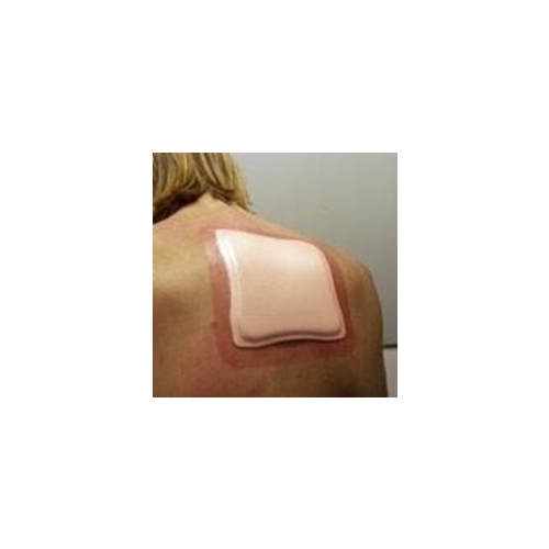 Līpošais putu pārsējs Allevyn Adhesive – 17,5×17,5cm ar apmali – 10 gab.