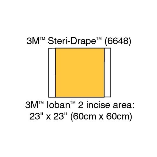 Incisionsdug loban antimikrobiel – 56x60cm (90x60cm) – 10 stk