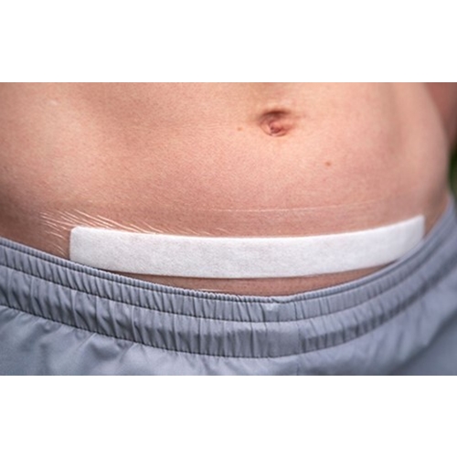 Superabsorberende forbinding Erland Care – 5x25cm silikonekant – 10 stk