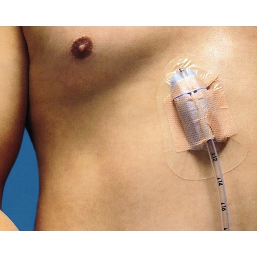Fixeringsförband för pleura dränage katetrar – 16-30Fr – 25 st